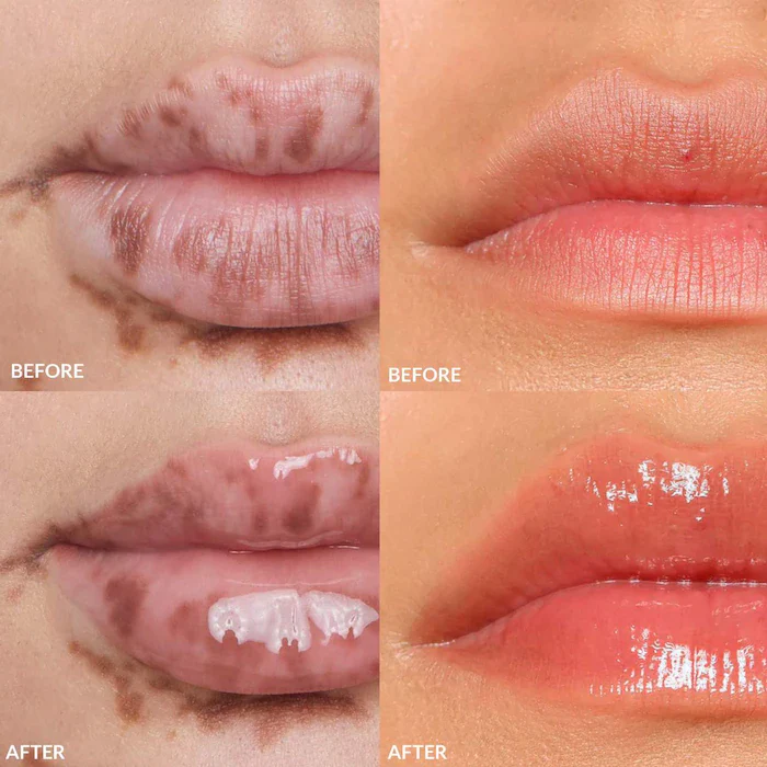 REFY - Mini Lip Gloss Set - Imagen 3